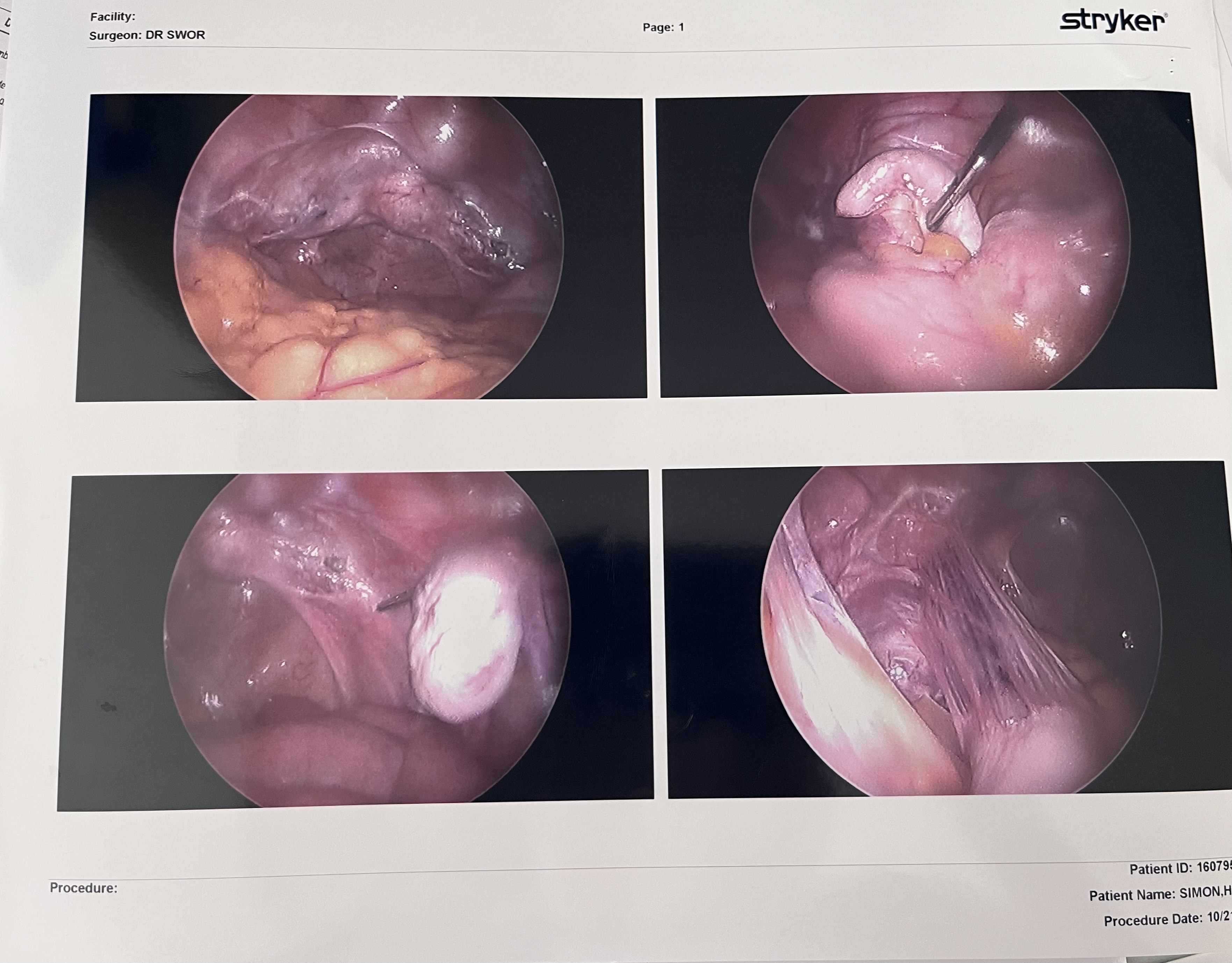 Laparoscopic Surgical Overview (4-panel)